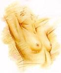 breast-augmentation_fig-a